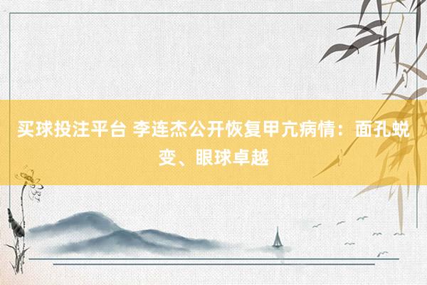 买球投注平台 李连杰公开恢复甲亢病情:面孔蜕变、眼球卓越